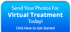 Virtual Orthodontic treatment at Orthodontics of San Mateo in San Mateo, CA