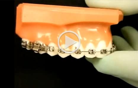 Emergency Care Orthodontics of San Mateo in San Mateo, CA