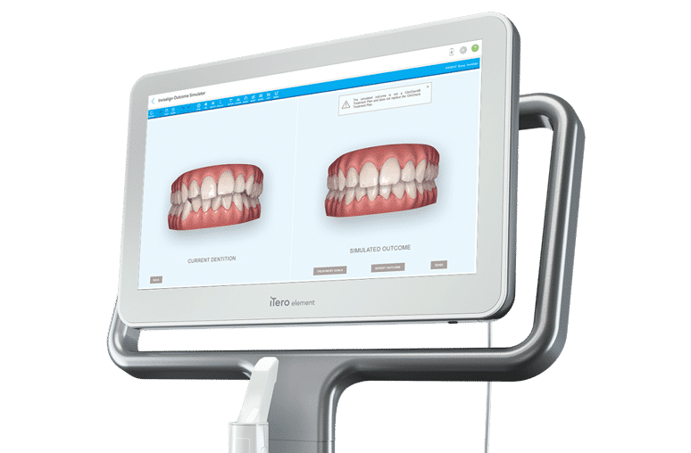 iTero - Orthodontics of San Mateo in San Mateo CA