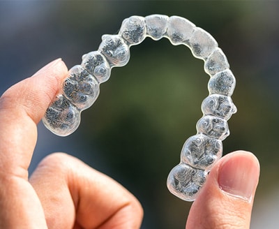 Clear Aligners - Orthodontics of San Mateo in San Mateo CA