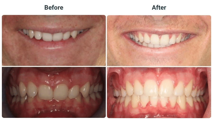 Contact Orthodontics of San Mateo San Mateo CA
